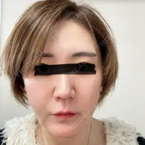 ゆきスキンクリニック 東池袋口コミ