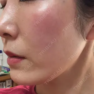 椿クリニック 名古屋院口コミ