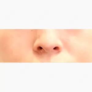 PRISM Beauty Clinic 町田院口コミ