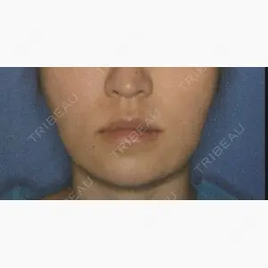 リッツ美容外科 東京院口コミ