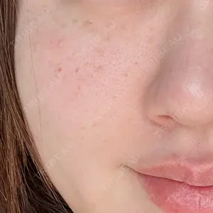 さっぽろ美容クリニック口コミ