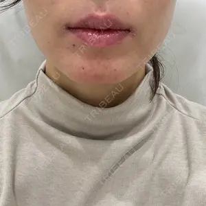 プライベートスキンクリニック 梅田本院口コミ