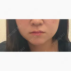おおたかの森ビューティークリニックthe art口コミ
