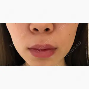 現代美学整形外科口コミ