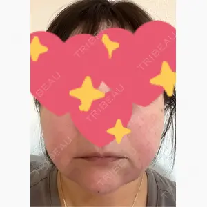 東京形成美容外科 船橋院口コミ