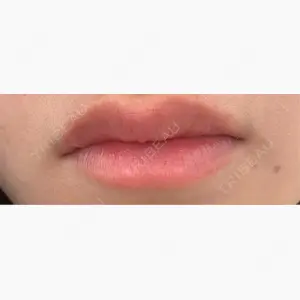 あいちビューティークリニック栄本院口コミ