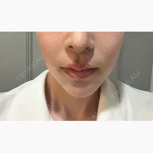 ルラ美容クリニック 町田院口コミ