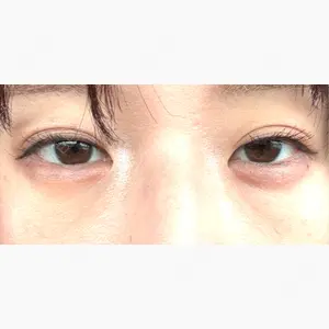 おおたかの森ビューティークリニックthe art口コミ