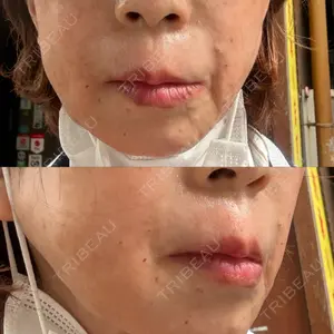 Natural Skin Clinic 笹塚院口コミ