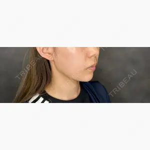 HAAB CLINIC 福岡院口コミ