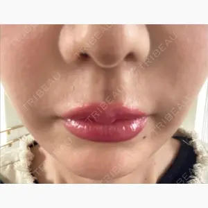 博多美容外科/美容皮膚科 ビラビューティークリニック口コミ