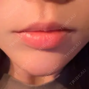 PRISM Beauty Clinic 町田院口コミ