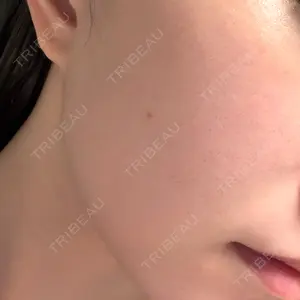 Ledian Clinic六本木口コミ