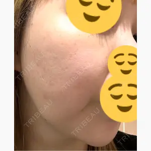 品川スキンクリニック銀座院口コミ