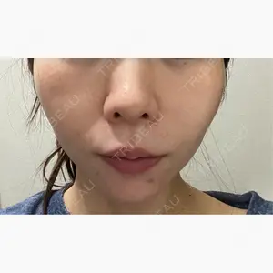 MIO CLINIC 梅田院口コミ