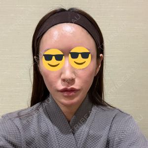 AVAN TOKYO 銀座脂肪吸引 クリニック口コミ