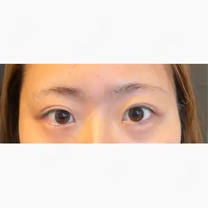 NARU Beauty Clinic 【ナルクリ】口コミ