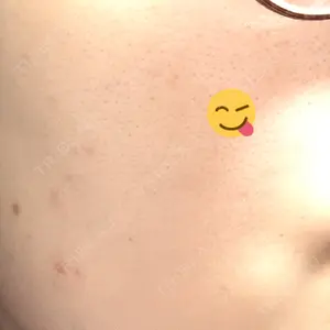 ルラ美容クリニック 渋谷本院口コミ