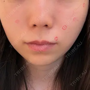 心斎橋KT美容クリニック口コミ