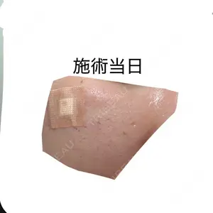 千葉美容外科アイビークリニック口コミ