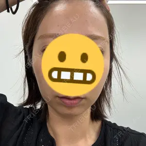 東京美容皮膚科アロエクリニック池袋西口院口コミ