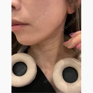 椿クリニック 心斎橋院口コミ