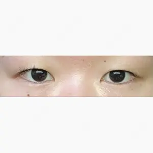 東京シンデレラ美容外科 池袋院口コミ