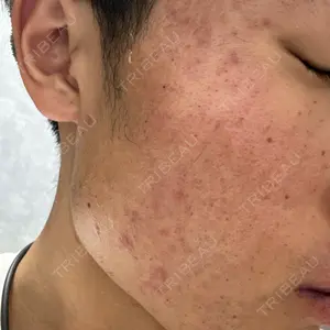 ミニマムスキンクリニック銀座口コミ