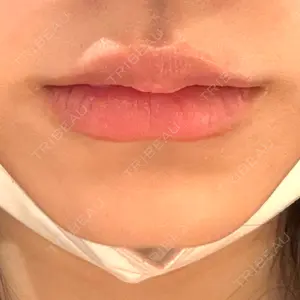 HAAB×DREAM BEAUTY CLINIC 大阪梅田院口コミ