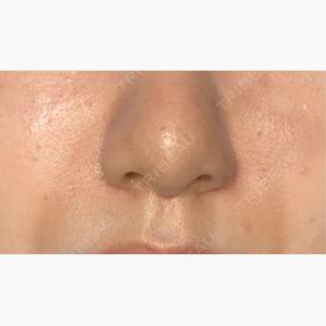 Code Beauty Clinic 名古屋院口コミ
