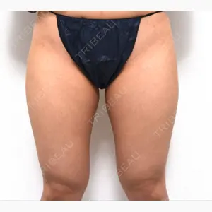 ドクターフィット（Dr.fit）クリニック口コミ