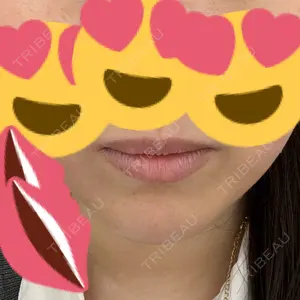 ゆきスキンクリニック 東池袋口コミ