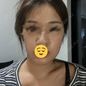 ゼノクリニック口コミ