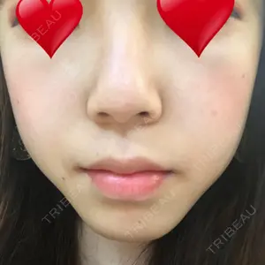 湘南美容クリニック 西宮北口院口コミ