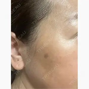 美容皮膚科 デュークリニック口コミ