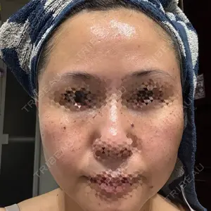 ルラ美容クリニック 宇都宮院口コミ
