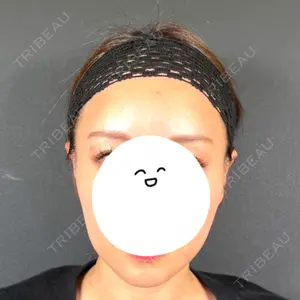 R Beauty CLINIC 名古屋院口コミ