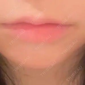 HAAB×DREAM BEAUTY CLINIC 大阪梅田院口コミ