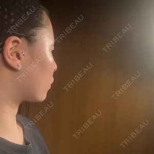 R Beauty CLINIC 銀座院口コミ