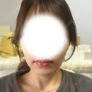 ルラ美容クリニック 大阪本院口コミ