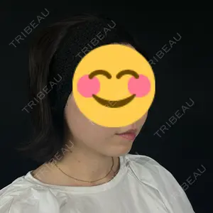 藤・ナチュレ美容クリニック 銀座院口コミ