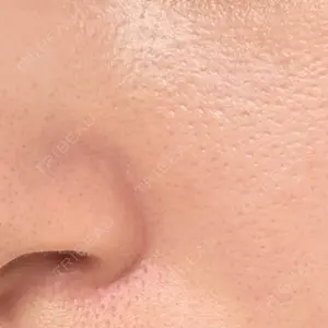 心斎橋KT美容クリニック口コミ