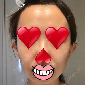 ウィーバー美容外科口コミ