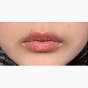 銀座美容外科クリニック 銀座院口コミ