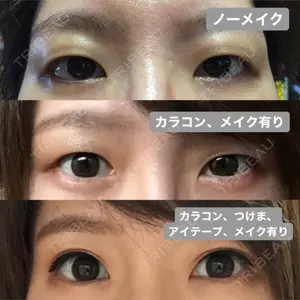 MIYAフェイスクリニック口コミ
