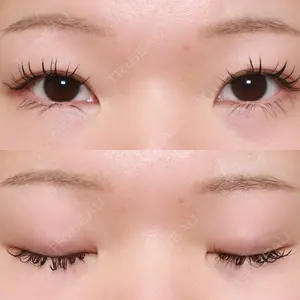 アリエル美容クリニック 大宮院口コミ