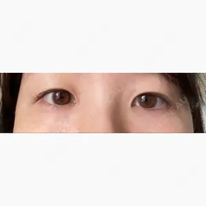 藤井美容外科口コミ