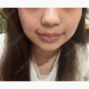 フィラークリニック 福岡院口コミ
