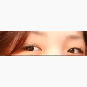 MIYAフェイスクリニック口コミ