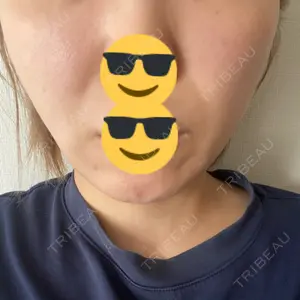 ルラ美容クリニック 広島院口コミ